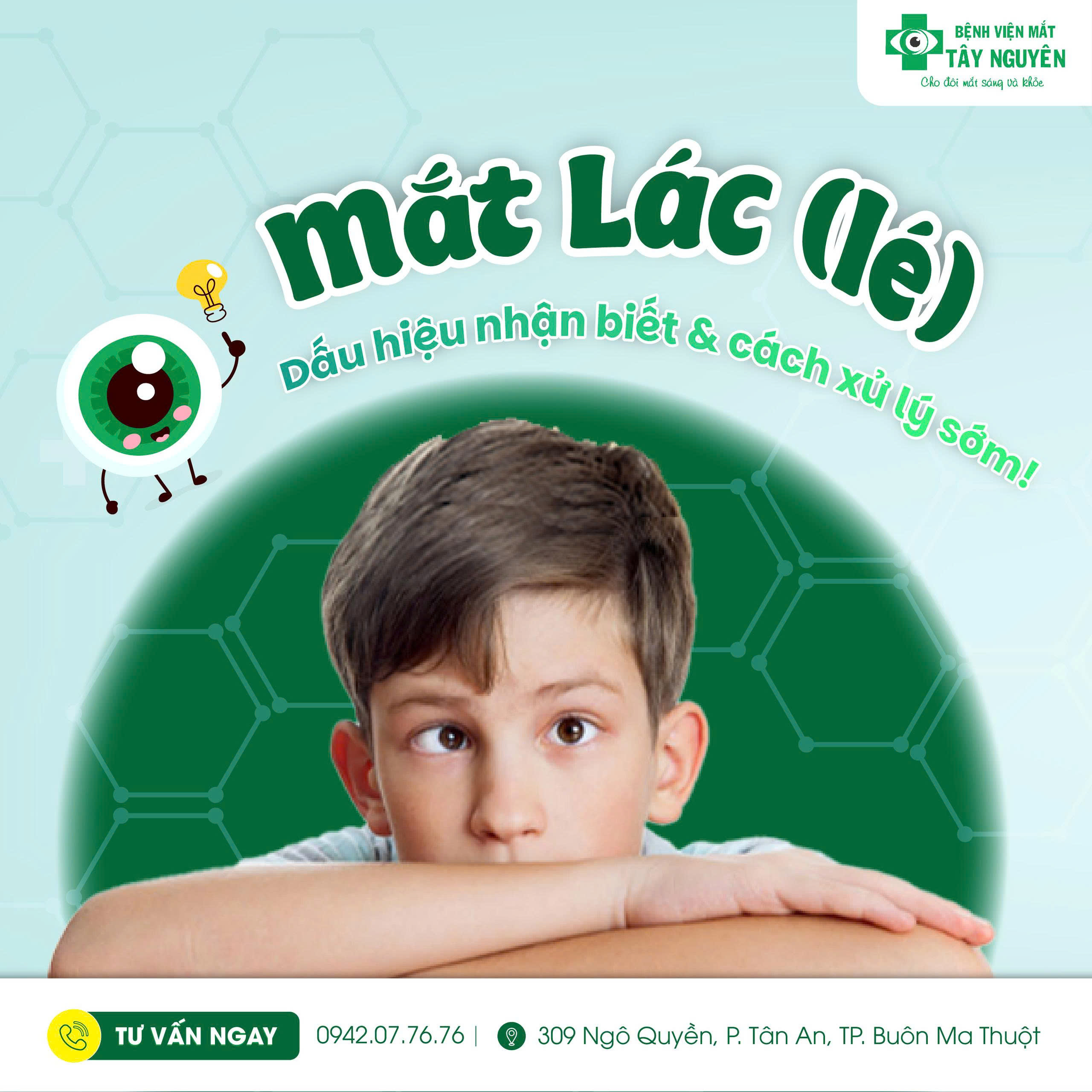 MẮT LÁC (LÉ): DẤU HIỆU NHẬN BIẾT VÀ CÁCH XỬ LÝ SỚM TẠI BỆNH VIỆN MẮT TÂY NGUYÊN